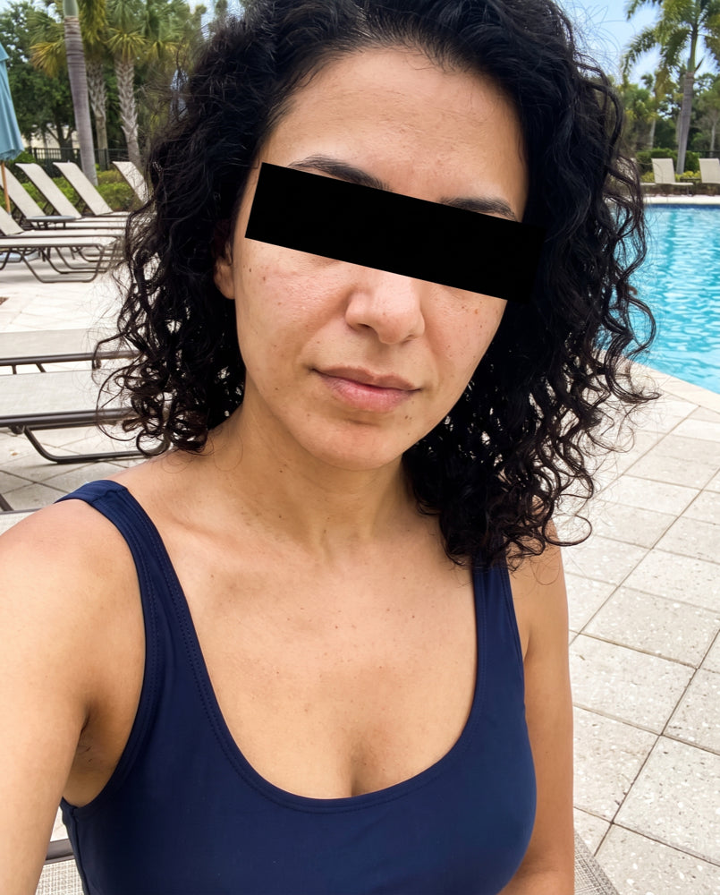 Before — selfie, week 1