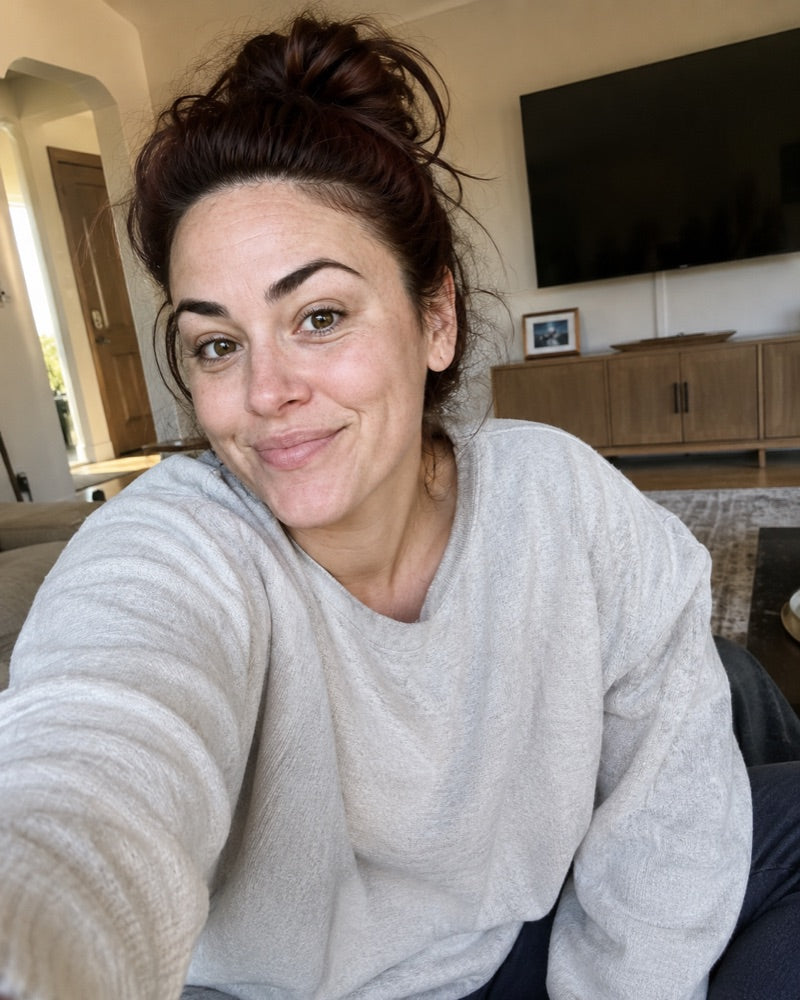 Before — fair freckled skin, week 1