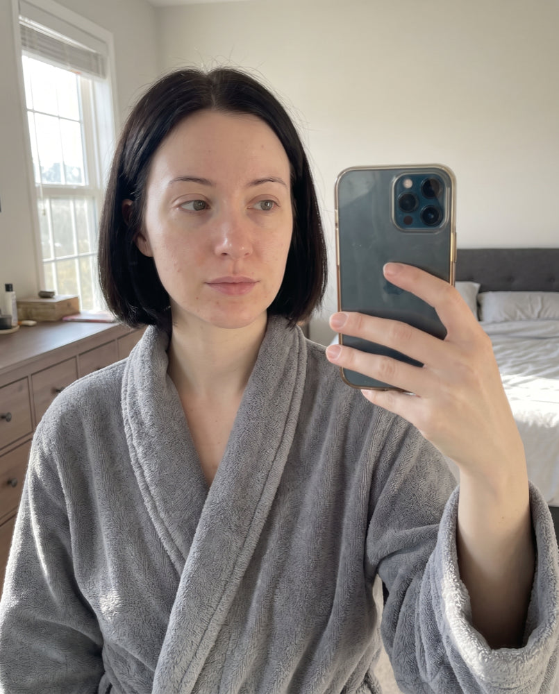 Before — mirror shot, day 1